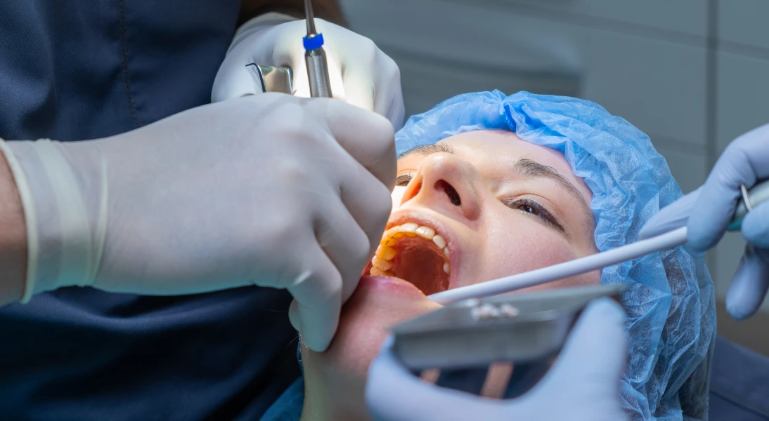 Cirugía Maxilofacial clinica dentala especialidad
