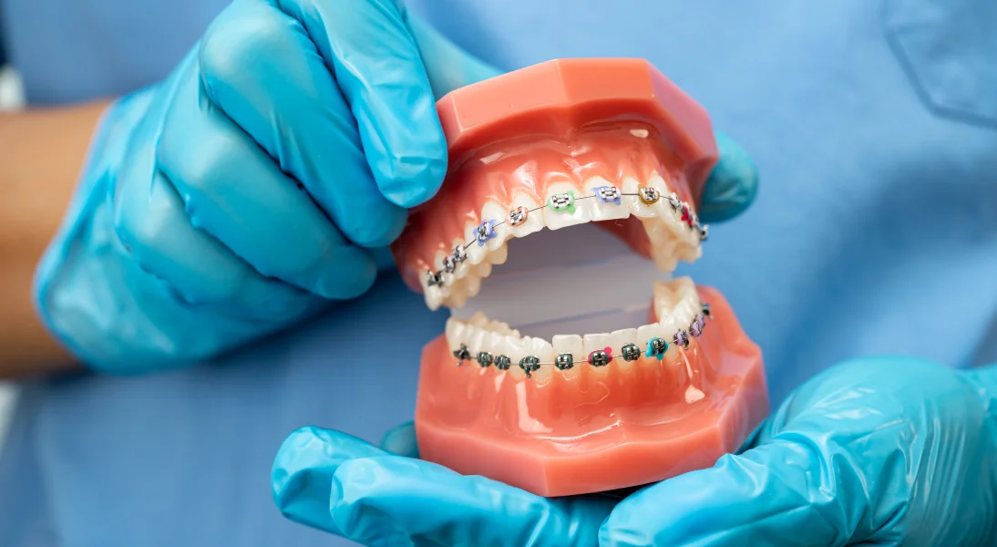 Ortodoncia especialidad clinica dental dentala