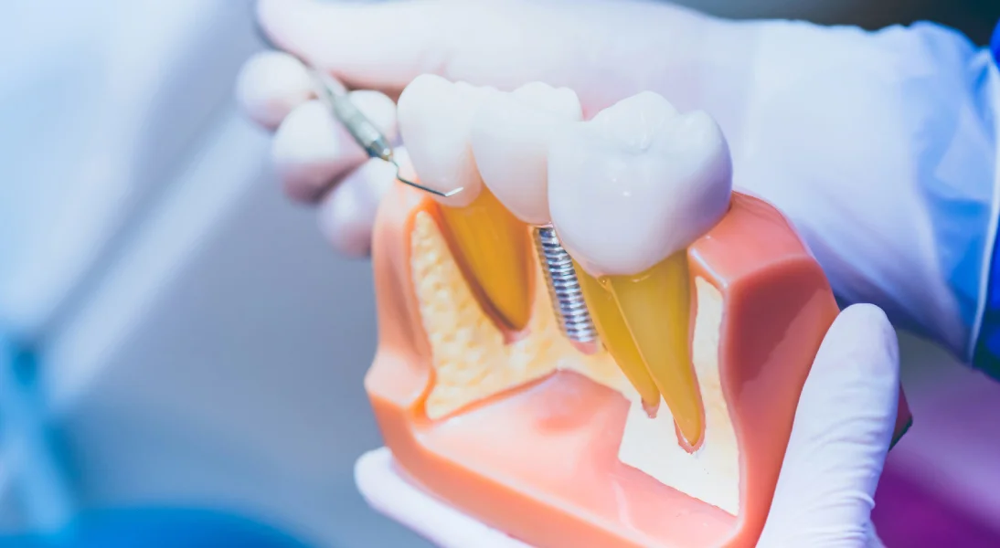 Periodoncia clinica dental dentala
